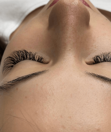 Skropstu pieaudzēšana Liepājā