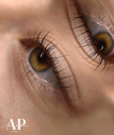 Beauty by Ance Podniece