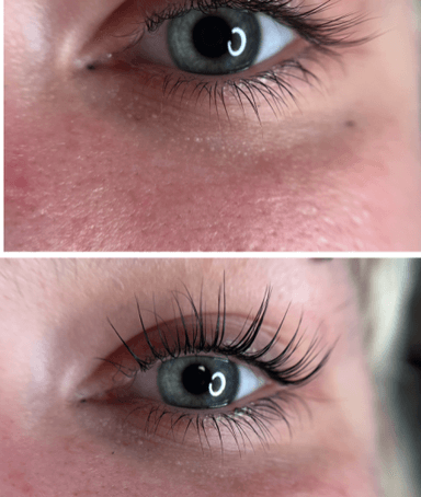 Soft TOUCH - Kristīna Ziediņa